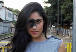 Mariana, la modella con una voglia nera sul viso
