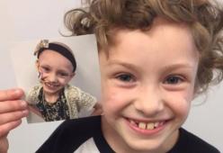 Sophie: a 7 anni sconfigge il cancro, l'emozionante foto del prima e dopo