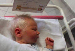 Incredibile in Ungheria: un bambino è nato con i capelli bianchi!