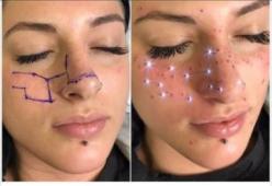 Nuova tendenza: tatuarsi il segno zodiacale con le lentiggini 