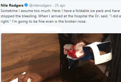 Nile Rodgers si rompe il naso e pubblica una foto splatter su Twitter