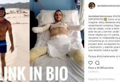 Gli amputano gambe e braccia per una meningite fulminante. L’appello di Davide sui social