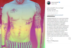 Marco Carta mostra la sua cicatrice su Instagram