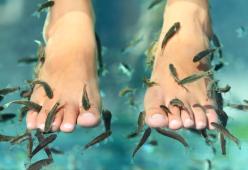 Donna perde le unghie dei piedi dopo la pedicure con i pesci