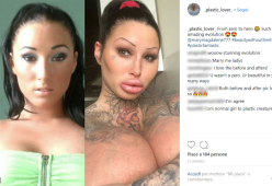 Appassionata di chirurgia estetica, decide di trasformarsi così... 