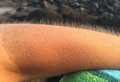 Ecco perché la musica ti fa venire la pelle d'oca