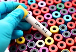 Addio al Pap Test, arriva il Test HPV 