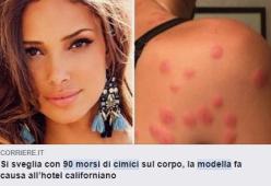 Si risveglia con 90 morsi di cimice sul corpo: modella denuncia un hotel in California 