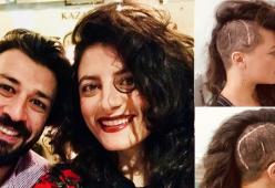 La moglie di Lele Spedicato svela una sua cicatrice in segno di solidarietà per il marito