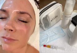 Victoria Beckham usa una crema di bellezza fatta con il suo sangue
