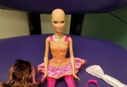 Barbie calva per aiutare le bimbe malate di cancro