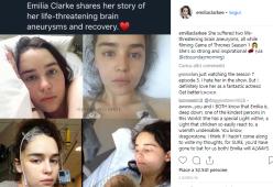 Emilia Clarke mostra le foto choc dopo l'intervento