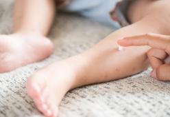 Epidemia morbillo a New York: il sindaco dispone la vaccinazione obbligatoria 
