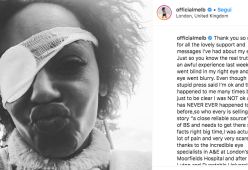 Spice Girls, Mel B non è diventata cieca: “Ho solo un’infezione che sto curando”