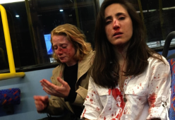 Coppia picchiata a sangue perché non si bacia all'ordine dei teppisti