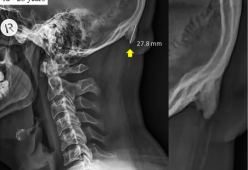 L'uso del cellulare fa crescere le "corna": una ricerca spiega il perché
