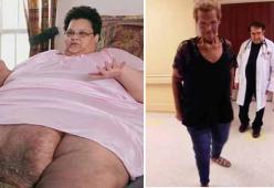 Perde 270 kg e torna a camminare: l'incredibile storia di Milla