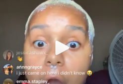 Perde tutti i capelli in diretta Instagram, ma ne esce alla grande
