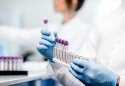 Contrae l'Hiv nel laboratorio dell'Università durante la tesi 