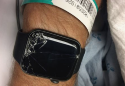 Cade dalla bici e batte la testa: lo smartwatch chiama i soccorsi salvandogli la vita
