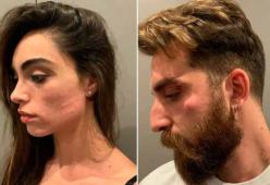 Ballerina di Amici minacciata e derubata con il marito
