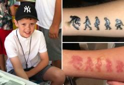 Bimbo ustionato da un tatoo all’henné: aveva assillato la madre per averlo