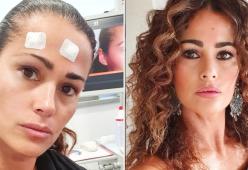 Samantha De Grenet asporta il celebre neo sulla fronte e lancia un appello