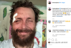 Jovanotti cade e si fa male facendo sport: “Oggi tolgo i punti”
