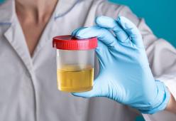 Il mistero del colore della pipì è stato finalmente svelato