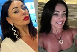 Fa un intervento alla vagina perché non piaceva all'ex fidanzato