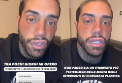 Francesco Chiofalo cambia il colore degli occhi: "È un mio sogno"