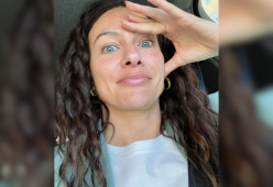 Paola Turani, reazione allergica al trucco: "Ho gli occhi gonfi"