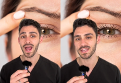 Tic all’occhio? Un dottore spiega le cause e come farlo smettere
