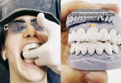 Achille Costacurta mostra la dentatura diamantata su TikTok