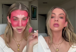 La “finta” scottatura: la nuova tendenza è virale su TikTok