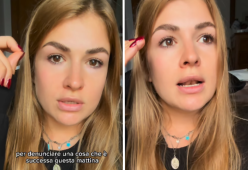 Veronica Rimondi: “Un uomo mi ha aggredito mentre facevo jogging”