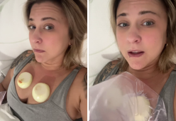 Tosse secca? Da Tik Tok consigliano: “Mettete cipolle sul petto”