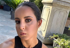 Camilla Mancini e la paresi al viso: “I bimbi non mi facevano giocare”