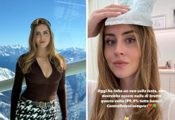 Valentina Ferragni, operazione per rimuovere un neo: come sta