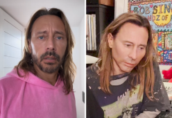 Bob Sinclar e il nuovo aspetto: si è sottoposto al botox?