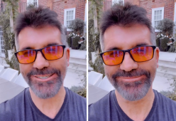 Simon Cowell, basta con i filler sul viso: “Li ho tolti tutti”