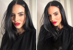 Grande Fratello, Shaila ammette i ritocchini: “Avevo il botox”