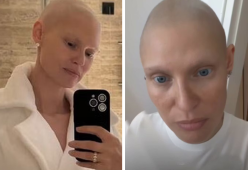 Bianca Balti mostra ai fan i primi segnali di ricrescita dei capelli