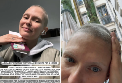 Bianca Balti, nuova cura per il cancro: i capelli stanno crescendo