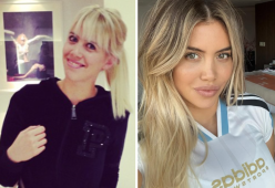 Wanda Nara prima e dopo: i ritocchi estetici a cui si è sottoposta