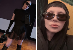 Lady Gaga: “Ho avuto una psicosi che mi ha allontanata dalla realtà”