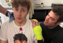 Fedez rompe il naso a Il Rosso durante uno sparring in diretta live