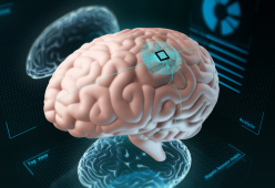 Scoperta plastica nel cervello umano: il dato che allarma