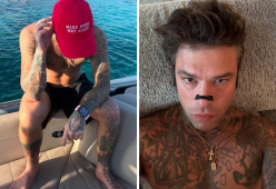 Fedez vittima di un furto a Forte dei Marmi: cosa è accaduto