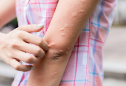 Stufo delle zanzare? Puoi usare la menta piperita per allontanarle